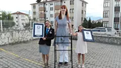 Rumeysa Gelgi est reconnue comme la femme vivante la plus grande du monde