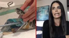 সাপের পেটে তোয়ালে