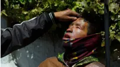 El rostro de un manifestante herido en el noveno día de protestas en Ecuador.