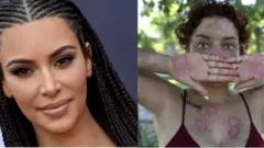 Kim Kardashian na nwaada Jokiva Bellard (onye nwere ọrịa "lupus")