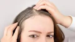 grey hair