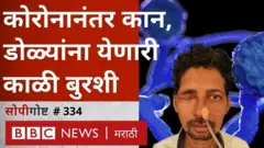 म्युकर सायकोसिस, काळी बुरशी, कोरोना व्हायरस