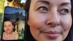 Aimee muestra una foto de su psoriasis