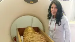 Dr Saleem says the scans of the body did not show any wounds or disfigurement due to disease
