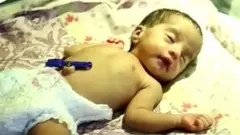 కవల పిల్లలు
