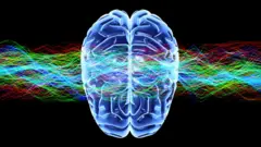 Ilustración de un cerebro