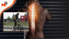 ابتكار غير مسبوق يمكّن رجل من المشي مجدداً بعد إصابة في النخاع الشوكي