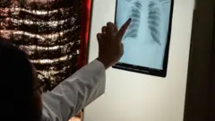 காசுநோய் சோதனை