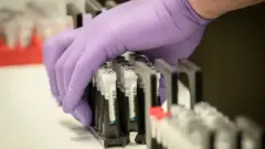 Prueba de laboratorio