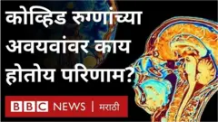 या अभ्यासातून कोव्हिडचे आरोग्यावर दूरगामी परिणाम काय होतायत हे पुढे येईल