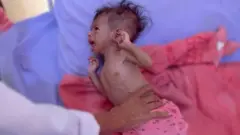"أوقفوا الحرب..عندها سنكون بخير"