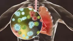 Virusi vya SARS-CoV-2 hupatikana juu na chini ya mapafu