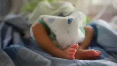 A rescued newborn