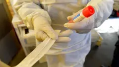 Koronavirüs test kiti