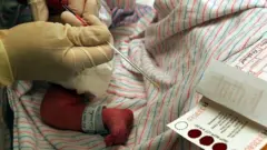 Profesional de la salud extrayendo sangre de un bebé
