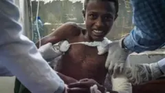 በቦምብ ጥቃት የደረሰበት ታዳጎ