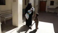 سوتغذیه شدید جان ۴۰۰هزار کودک یمنی را تهدید می‌کند