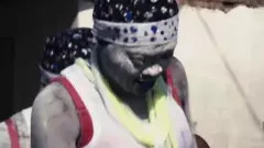 FGM