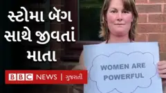 સ્ટોમા બૅગ