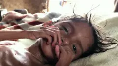 خمس سنوات من الجوع وخمس سنوات من النزاع