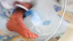 New born foot