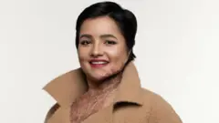 एसिड आक्रमणमा परेकी महिला