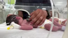 A baby in an incubator is attended to by a medical workers