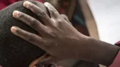 Onye nwere ọrịa isi