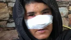 नवऱ्याकडून मारझोड सहन करणाऱ्या झाकराला एकेदिवशी अनपेक्षित प्रकाराला तोंड द्यावं लागलं...संतापलेल्या नवऱ्यानं तिचं नाकच कापलं.