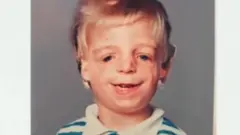 يقول جونو لانكستر إن والديه تخليا عنه عند الولادة بسبب شكله.