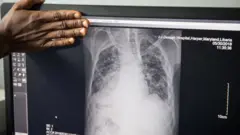 Aworan igba aya ẹni to ni ikọ fee