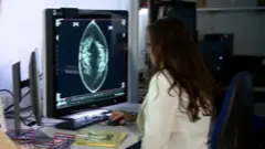 ম্যামোগ্রাম পরীক্ষা করে দেখা হচ্ছে।