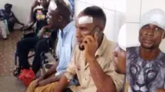 Ụmụafọ Igbo e merụrụ nnukwu ahụ na Togo