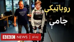 فرانسوي روباټیک انجنیر جین لویس کونستانزه خپل ۱۶ کلن زوی ته د بهرني ایسکلېټ داسې روباټیکي جامې جوړې کړې