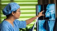 બીબીસી ગુજરાતી, ગુજરાત, હેલ્થ, સ્વાસ્થ્ય,બ્રેન સ્ટ્રોક, અમદાવાદ, ભારત