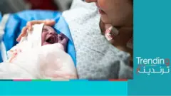 % 80 نسبة الولادة القيصرية في مصر ووزارة الصحة تحذر من مخاطرها