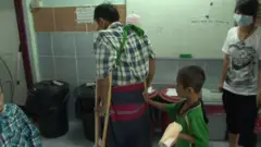 မြန်မာပြည်တွင်းစစ်နဲ့ ကိုယ်အင်္ဂါအစိတ်အပိုင်း ဆုံးရှုံးမှု