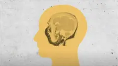 BBC graphic