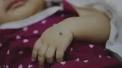 Dengue Fever