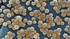 Estafilococo resistente à meticilina.