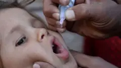ګوزڼ