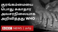 குரங்கம்மை