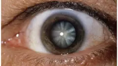 عين