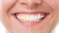 දත්