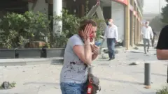 لبنانية مصابة