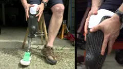 prosthetic leg