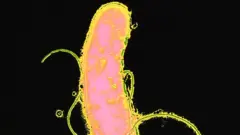 Igice cya kabiri ku ndwara ya helicobacter pylori mu bisobanuro bya Muganga Willy Mucyo