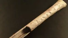 Tulang paha manusia