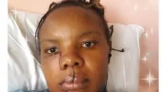 Teresia Njeri alipofanyiwa upasuaji