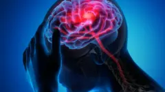 የጭንቅላት ምስል